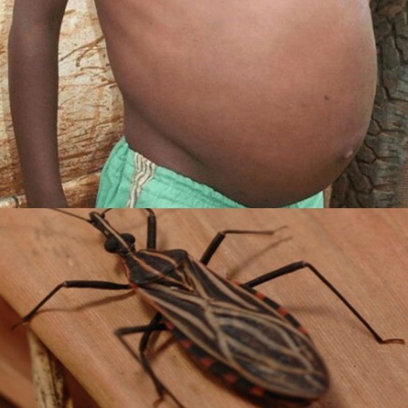 Pesquisadores vão estudar a Esquistossomose e a Doença de Chagas